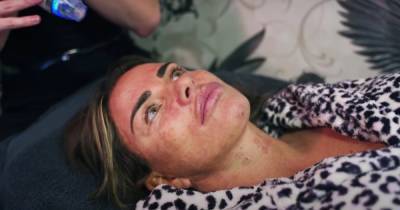 Katie Price shares latest £700 beauty treatment which left her face bleeding - www.ok.co.uk