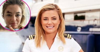 Below Deck Med’s Malia White Hospitalized With Broken Bones Following Scooter Incident: ‘Accidents Happen When You Least Expect’ - www.usmagazine.com - Spain