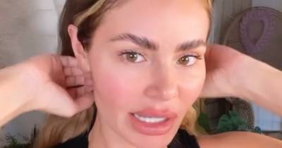Chloe Sims shows off natural look after having fillers dissolved in make-up free video - www.ok.co.uk - Hague