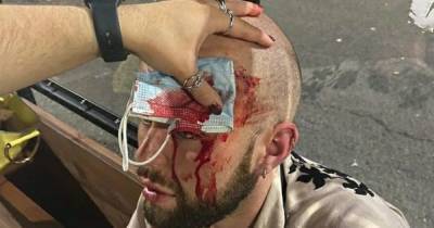 Gay man 'thought he would die' after homophobic attack left him covered in blood - www.dailyrecord.co.uk