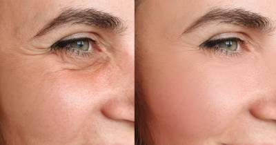 Shoppers Can’t Stop Sharing Amazing Results Pics of This Anti-Aging Serum - www.usmagazine.com