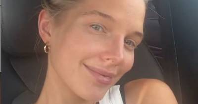 Helen Flanagan reveals the effect of hayfever on her appearance - www.manchestereveningnews.co.uk