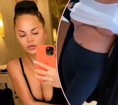 Chrissy Teigen Jokes About Breast Surgeries -- And Shows Off Scars One Year Later - perezhilton.com