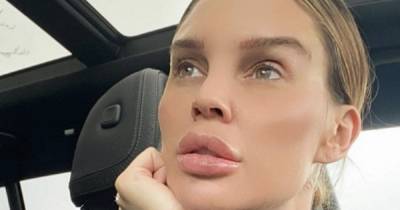 Danielle Lloyd shares how she reduced skin pigmentation in incredible transformation snap - www.ok.co.uk