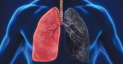 Synexus needs your help to research additional treatment options to prevent and control COPD flare-ups - www.manchestereveningnews.co.uk
