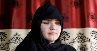 Mum whose eyes were gouged out by Taliban claims women are 'fed to dogs' - www.dailyrecord.co.uk - city Delhi