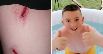 'Come forward, coward': Mum speaks of horror after son, 8, attacked by dog at park - before 'owner runs off' - www.manchestereveningnews.co.uk - county Hall - Germany