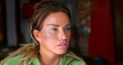 Katie Price pictured with bruised face after alleged assault at her Essex home - www.ok.co.uk