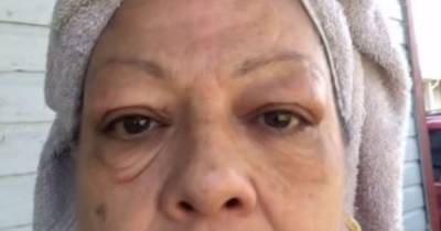 Viral video shows £34 eye cream miraculously removing eye bags in just seconds - www.ok.co.uk