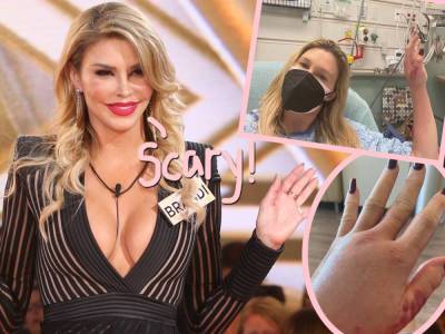 Brandi Glanville Hospitalized With Horrifying Mystery Infection After Being Warned She 'Could Lose A Limb'! - perezhilton.com