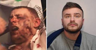 Victim lost his job and left terrified after brutal stranger glasses him in vicious attack in middle of family pub - www.manchestereveningnews.co.uk