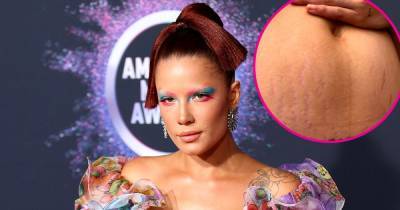 Halsey Shares a Candid Snap of Their Postpartum Body: ‘This Is What It Look Like’ - www.usmagazine.com