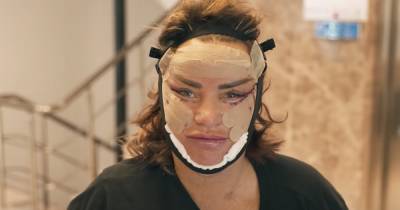 Katie Price insists she has 'no regrets' as star shares new gruesome video of face and lip lift surgery - www.ok.co.uk - Turkey