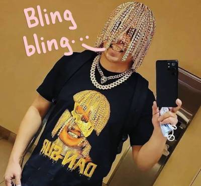 Rapper Gets Gold Chains 'Surgically Implanted' Into His Head As Blinged-Out Hair -- WTF?! - perezhilton.com - Colombia