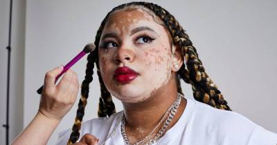 The model changing the face of fashion in Manchester as she embraces skin condition triggered by childhood trauma - www.manchestereveningnews.co.uk - Manchester - Bermuda