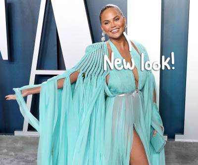 Chrissy Teigen Reveals She Underwent Cheek Fat Removal Surgery -- See Her New Face! - perezhilton.com