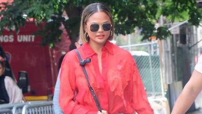 Chrissy Teigen says she had fat removed from her cheeks: 'No shame in my game' - www.foxnews.com