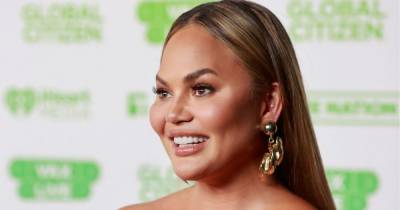 Chrissy Teigen shows bone structure after having fat surgically removed from her cheeks - www.ok.co.uk