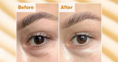 This Eye Cream Could Visibly Reduce Dark Circles in Just 7 Days - www.usmagazine.com