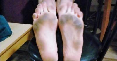 Dad shares photos of dirty feet after a 'day of walking around his Pontins chalet' - www.manchestereveningnews.co.uk