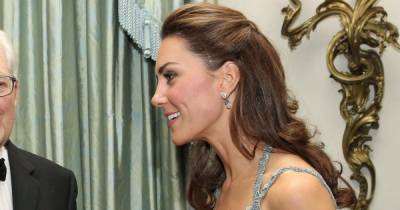 Kate Middleton has scar on her head from a childhood operation and Prince William has one too - www.ok.co.uk