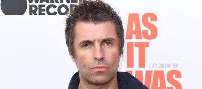Oasis' Liam Gallagher Falls Out of Helicopter, Shares Photo of His Facial Injuries - www.justjared.com - county Isle Of Wight
