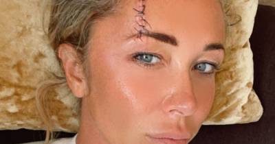 Atomic Kitten's Jenny Frost updates fans as she shares extent of injuries after Ibiza fall - www.manchestereveningnews.co.uk