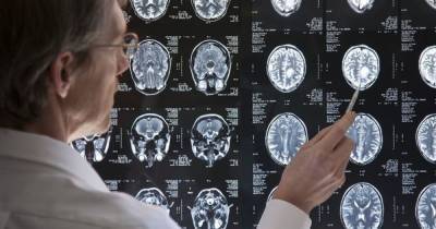 Warning over three common lifestyle habits that increase risk of dementia - www.dailyrecord.co.uk - Netherlands