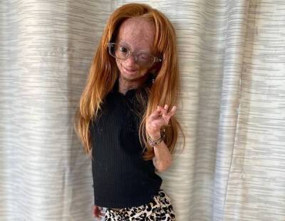 Michael Costello - Williams - YouTuber Adalia Rose Williams Dead At 15: ‘Now Dancing To All The Music She Loves’ - perezhilton.com - New Zealand - Texas - Chicago