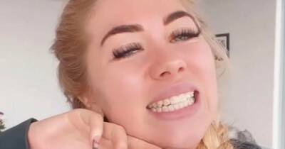 Paige Turley - Love Island winner Paige Turley's hopes for 'summer smile' dashed after dog ate her braces - dailyrecord.co.uk - Australia - Manchester