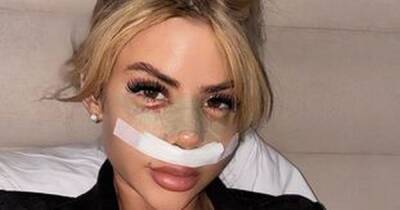 Love Island's Hannah Elizabeth shows off nose job results after jetting off to Turkey for op - www.ok.co.uk - Turkey - city Istanbul