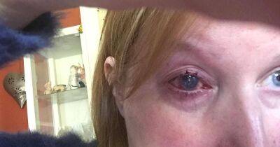 Gran loses eye after wearing contact lenses in shower - manchestereveningnews.co.uk - Manchester