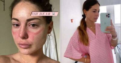 Louise Thompson reveals she has lupus as she shares health update - www.msn.com - Chelsea