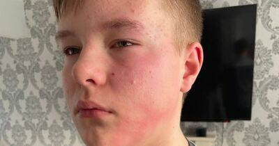 Boy left with swollen face after being 'punched by grown man' at pal's house - dailyrecord.co.uk
