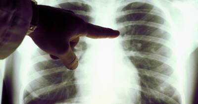 Lung disease symptoms as UK death rates are one of highest in Europe - www.dailyrecord.co.uk - Britain - Scotland - Turkey