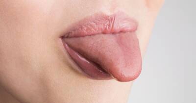 Sign of Vitamin B12 deficiency that you might spot on your tongue - www.dailyrecord.co.uk