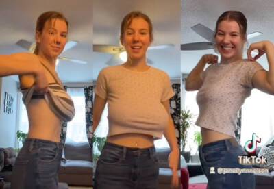 Doctors Refused This Woman A Breast Reduction 10 Times Despite Her Constant Pain -- Saying 'Think Of Your Future Husband'! - perezhilton.com - Canada