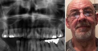 'I thought I was in safe hands’: Routine dentist appointment left wood chipper 'in agony and hospitalised for 17 days' - www.manchestereveningnews.co.uk
