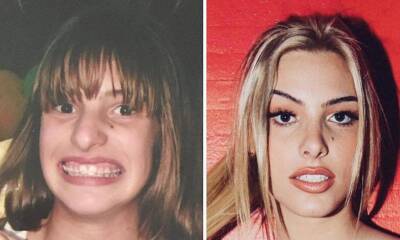 Lele Pons ‘exposes herself’ with adorable before and after rhinoplasty pics - us.hola.com