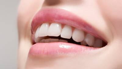 Everything You Need to Know About Teeth Whitening - www.glamour.com