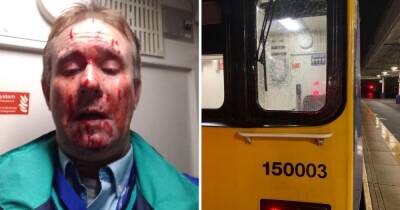 Horrific image shows driver's brutal injuries after brick launched at 70mph train - www.manchestereveningnews.co.uk - Britain