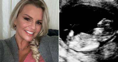 Kerry Katona apologises after fake ultrasound scan in April Fool's Day post - www.dailyrecord.co.uk