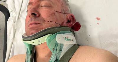 Cyclist says he's lucky to be alive after being left with bleed on the brain and punctured lung in hit-and-run - www.manchestereveningnews.co.uk - Britain - Manchester