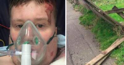 Scots teen left 'impaled' on garden face after horror bike fall - www.dailyrecord.co.uk - Scotland