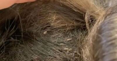 Hairdresser shares images of schoolgirl's six-MONTH head lice infestation - www.manchestereveningnews.co.uk - Britain - Manchester