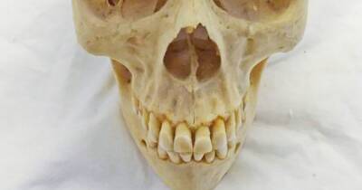 Human remains removed from Scots auction sale after backlash - www.dailyrecord.co.uk - Britain - Scotland - county Montrose