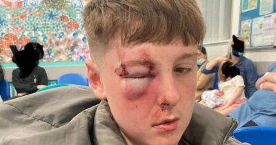 Schoolboy 'beaten with baseball bat' suffers fractured eye socket during incident - www.dailyrecord.co.uk - Birmingham