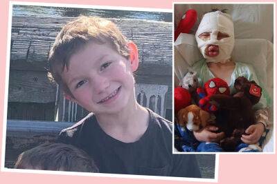 6-Year-Old Boy Set On Fire & Nearly Killed, Allegedly By His 8-Year-Old Bully - perezhilton.com - New York - state Connecticut