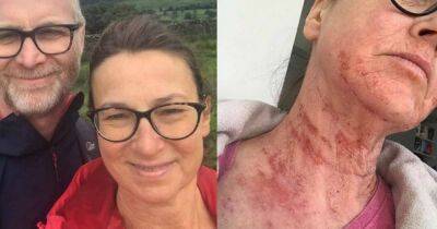 Woman says her skin 'sheds like a snake' due to steroid cream 'addiction' - www.manchestereveningnews.co.uk