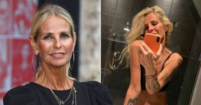 Ulrika Jonsson reveals 'debilitating' arthritis leaves her struggling to get out of chairs - www.msn.com